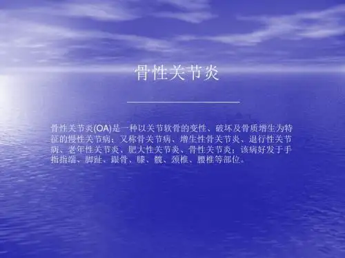 骨性关节炎ppt课件