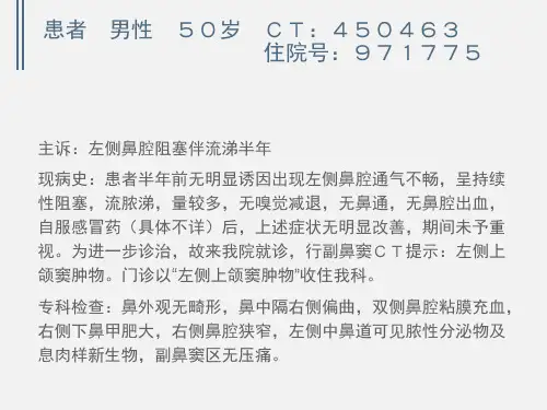 鼻腔副鼻窦肿物