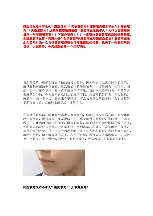 脂肪填充根本不永久 脂肪填充 天恢复照片