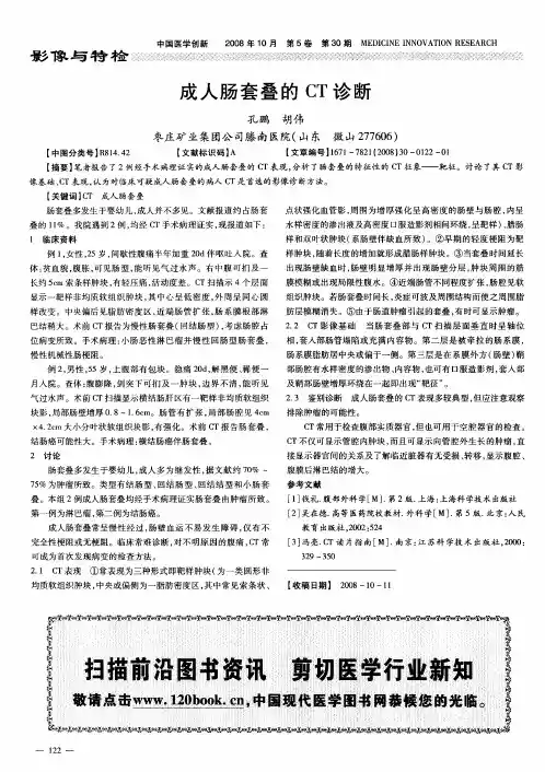 成人肠套叠的CT诊断