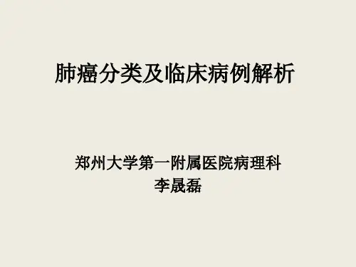 肺癌新分类解读