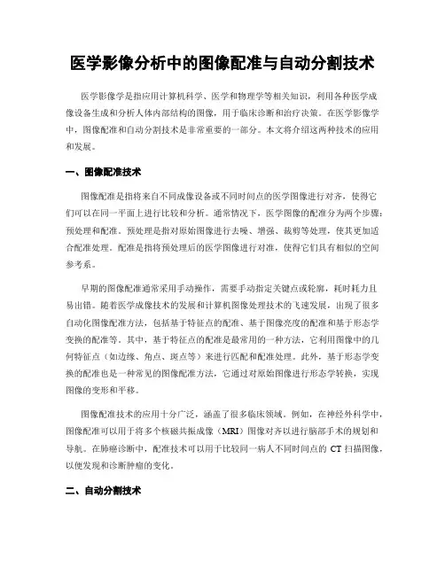 医学影像分析中的图像配准与自动分割技术