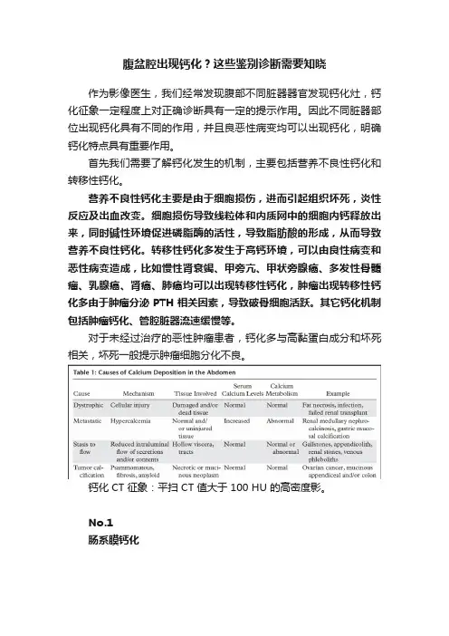 腹盆腔出现钙化？这些鉴别诊断需要知晓