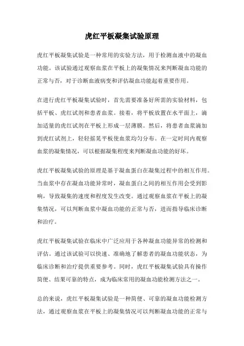 虎红平板凝集试验原理