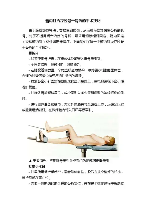 髓内钉治疗胫骨干骨折的手术技巧