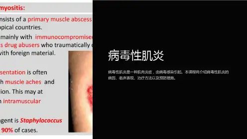 《病毒性肌炎》课件