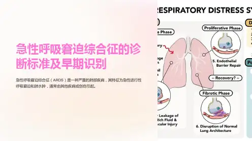 急性呼吸窘迫综合征的诊断标准及早期识别