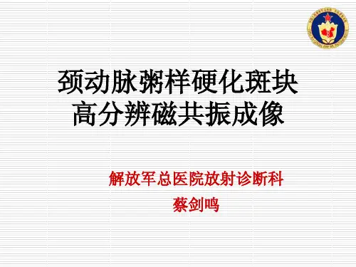 蔡剑鸣--颈动脉粥样硬化斑块的高分辨磁共振成像-2012-7