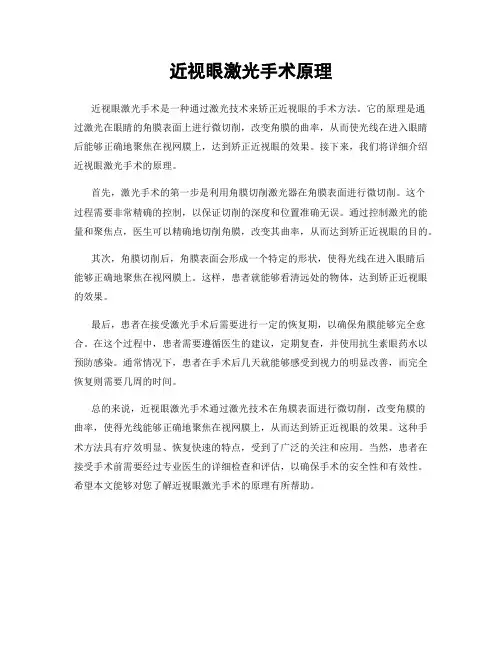 近视眼激光手术原理