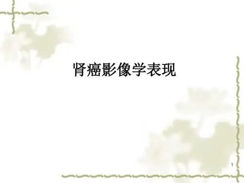 肾癌影像学表现ppt课件