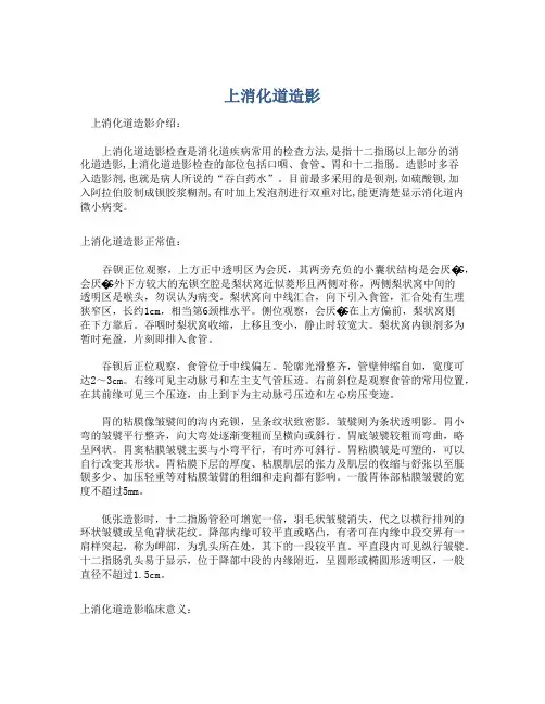 上消化道造影
