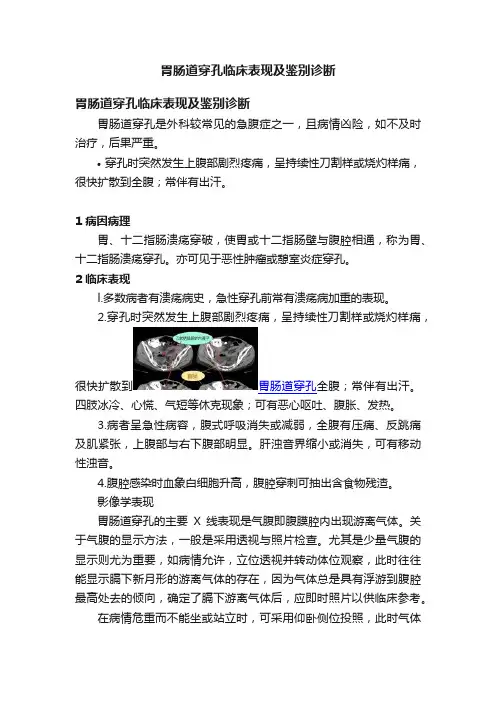 胃肠道穿孔临床表现及鉴别诊断