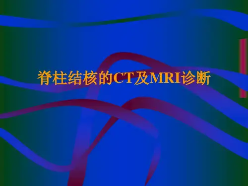 影像学,脊柱结核的CT及MRI诊断