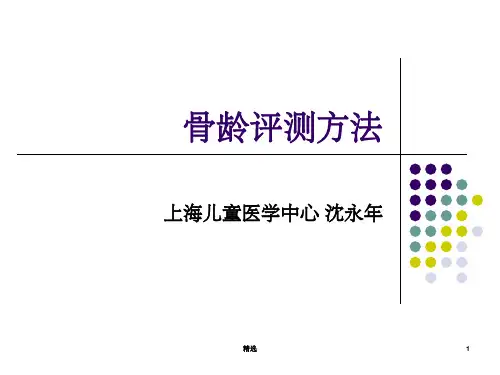 骨龄评测方法ppt课件
