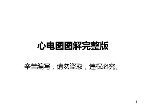 心电图全部图解全集PPT课件