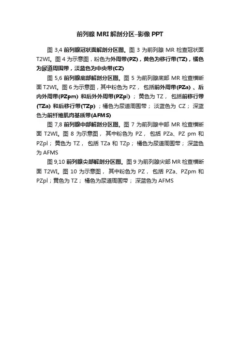 前列腺MRI解剖分区–影像PPT