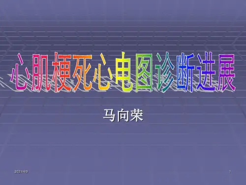 心肌梗死心电图诊断进展
