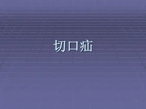 培训学习资料-切口疝-2023年学习资料