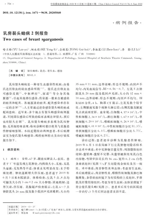 乳房裂头蚴病2例报告