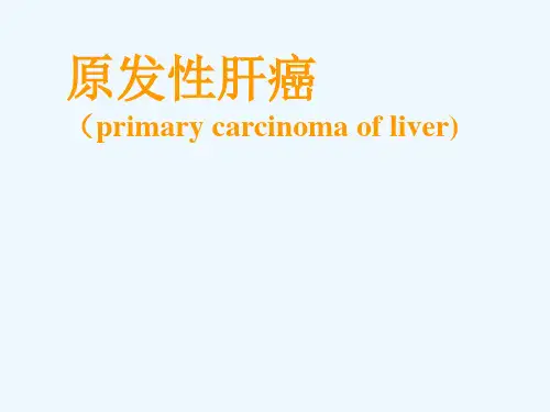 原发性肝癌西医内科