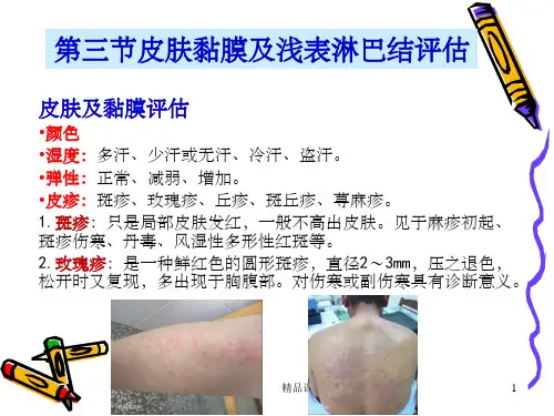 健康评估皮肤黏膜及浅表淋巴结评估