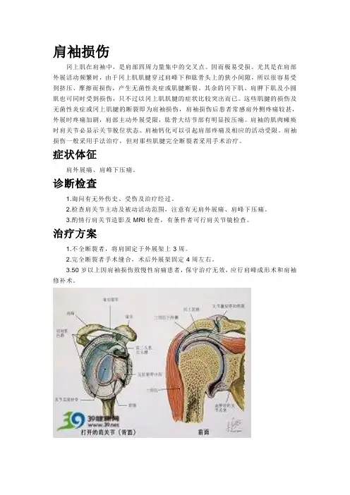 右侧肩袖损伤