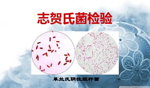 志贺氏菌检验