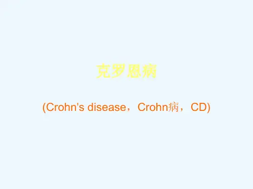 克罗恩病