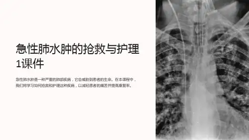 急性肺水肿的抢救与护理1课件