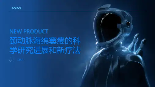 颈动脉海绵窦瘘的科学研究进展和新疗法