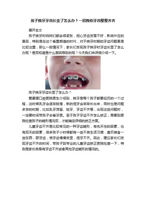 孩子换牙牙齿长歪了怎么办？一招教你牙齿整整齐齐