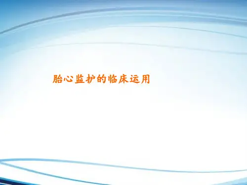 胎心监护的临床运用
