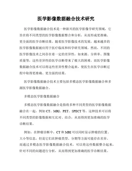 医学影像数据融合技术研究