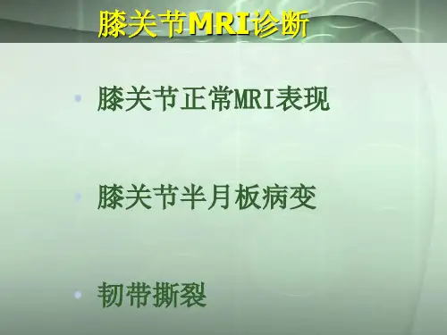 膝关节核磁共振诊断参考PPT