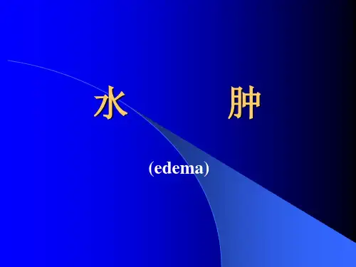 病理生理学-水肿