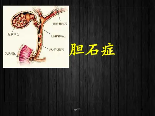 胆石症胆道感染  ppt课件