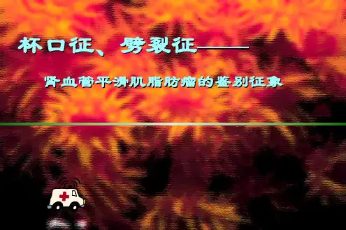 杯口征、劈裂征——肾血管平滑肌脂肪瘤的鉴别征象