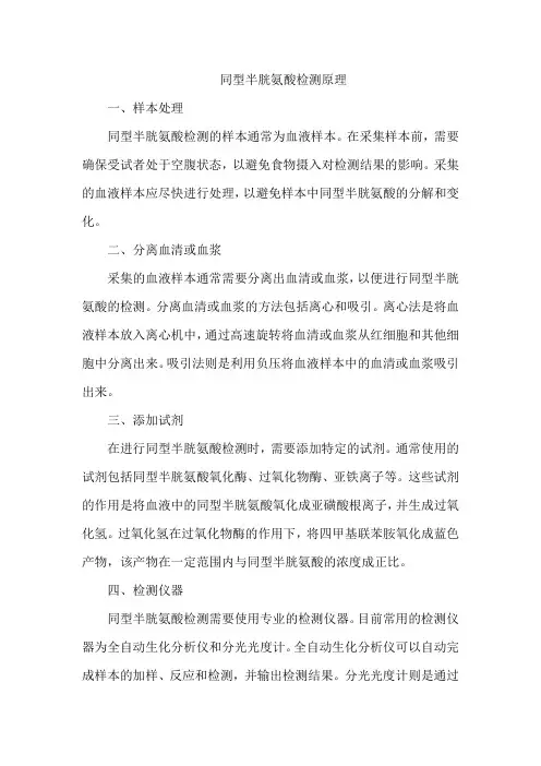 同型半胱氨酸检测原理