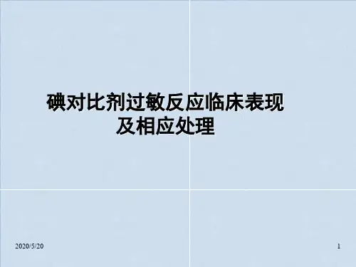 碘造影剂过敏反应临床表现、抢救流程及相关处理