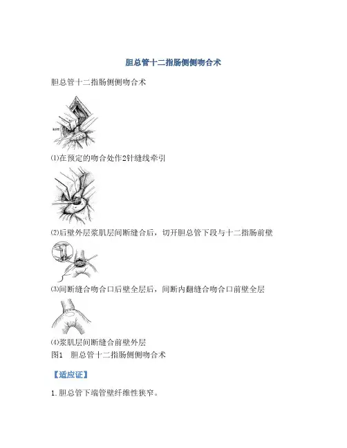 胆总管十二指肠侧侧吻合术