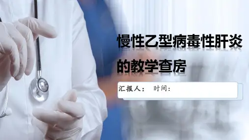 慢性乙型病毒性肝炎的教学查房