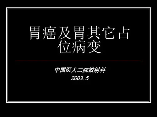 医学影像-胃癌及胃其它占位病变影像学