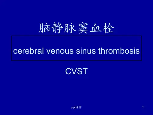 脑静脉窦血栓  ppt课件