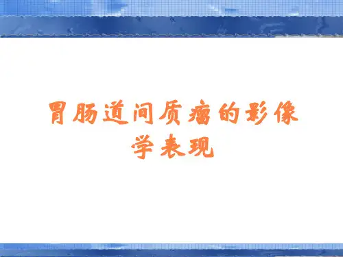 胃肠道间质瘤的影像学表现