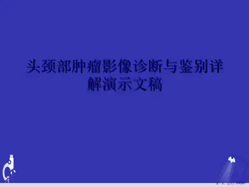 头颈部肿瘤影像诊断与鉴别详解演示文稿