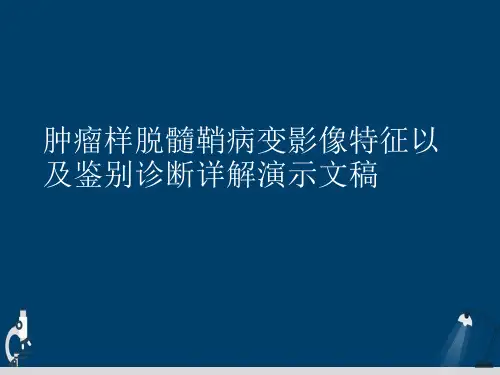 肿瘤样脱髓鞘病变影像特征以及鉴别诊断详解演示文稿