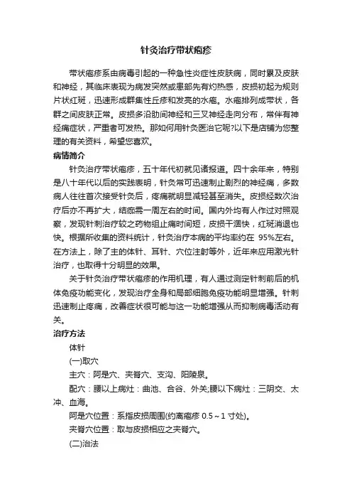 针灸治疗带状疱疹