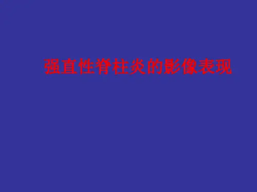 强直性脊柱炎的影像表现 PPT课件