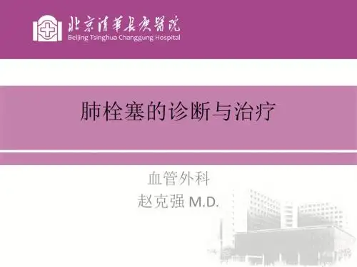 肺栓塞的诊断与治疗进展