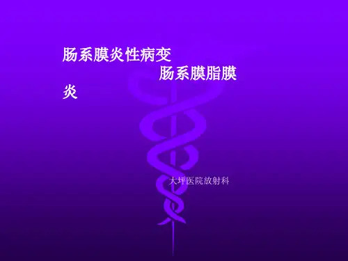 肠系膜脂膜炎影像学表现